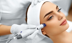 Microdermabrasion Sessions at Anna Beauty Center (Up to 46% Off)