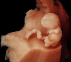 Up to 27% Off on Ultrasound - 3D / 4D at Baby Fairy Tale - 3D/4D HDLive Ultrasound
