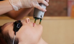 Up to 70% Off on IPL Photo Facial at Paris Lanae Makeup & Bar