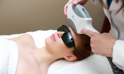 One Photofacial with Optional Dermaplaning Treatment at IPL and Skin Wellness (Up to 60% Off)
