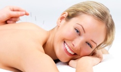 One or Two 60-Minute Sessions of Acupuncture at Amy Li Acupuncture Care (Up to 83% Off)