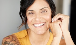 $91.20 for an IPL Photofacial at Valley Cosmetic Laser Center ($250 Value)