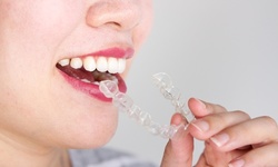 $3,273.50 for Invisalign with Teeth Whitening at Dr. Nicholas Garcia General & Cosmetic Dentistry ($5,500 Value)