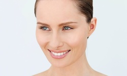 One, Two, or Four IPL Photofacials at DrRcosmetics (Up to 84% Off)