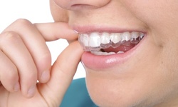 $15.20 for Consultation and Invisalign Treatment at Newton Dentistry ($2,200 Value)