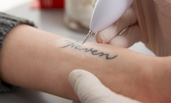 $126 for Three Laser Tattoo-Removal Sessions for a  2”x2” Area at LaserTouch Aesthetics ($600 Value)