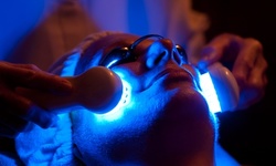 Two, Four, or Six IPL Photofacial Treatments for Face or Hands at Alliance Health Choice (Up to 76% Off)