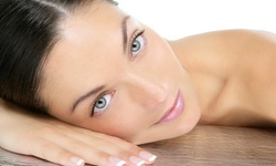 One or Three IPL Photofacials at Style International (Up to 60% Off)