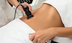 Two, Four, or Six Laser Sculpt Lipo Treatments at Ultra Body Sculpting (Up to 88% Off)