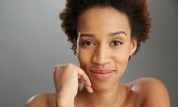 $187 for One V-Beam Perfecta Treatment at Dermatology, Laser and Surgery of Flatiron ($600 Value)