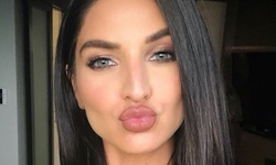 One or Two Vials of Sculptra Aesthetic at Face Forward Aesthetics (Up to 33% Off)