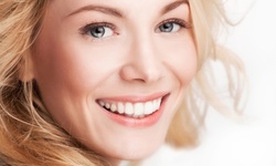 20 or 40 Units of Botox at Skinzone Medical (Up to 50% Off)