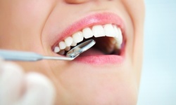 Up to 90% Off on Dental Checkup (Cleaning, X-Ray, Exam) at VALLEY FAMILY DENTAL GROUP