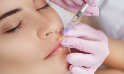 Juvederm Injections at Faces Med Spa (Up to 49% Off). Three Options Available.