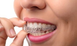 $26.25 for $1,005 Worth Of Credit Toward Complete Invisalign Treatment at Dental Health Care Associates