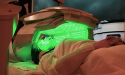 Facial Acne Light Therapy Session with Optional Microdermabraision at ACS Pro Med Spa (Up to 89% Off)