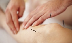 Acupuncture Sessions or Energy-Light Rejuvenation Facials at CW Acupuncture (Up to 85% Off)