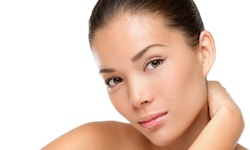 Microdermabrasion with IPL at Pari Skin Care (Up to 64% Off) 