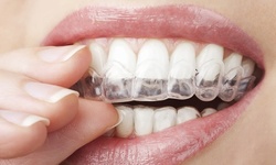 Complete Invisalign Treatment with Option of Teeth Whitening at Williams Dental Wellness (Up to 62% Off)