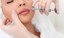 20 Units of Botox or One Syringe of Juvederm Ultra XC or Voluma XC at Freeze The Fat Dr. (Up to 47% Off)