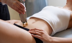 6 Laser Hair-Removal Treatments on a Small, Medium, or Large Area at ProSkin Esthetics and Laser (Up to 65% Off)