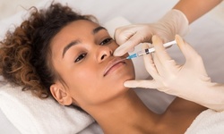 $375 for 1ml Syringe of Restylane at Clinic Femina ($750 Value)