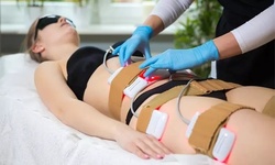 Up to 88% Off on Liposuction - Non-Invasive Laser (iLipo) at Black Cat Sculpt Bar