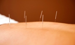 One or Three Acupuncture Sessions at American Academy of Acupuncture and Oriental Medicine (Up to 52% Off)