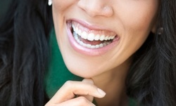 $42.50 for Dental Exam with X-rays and Cleaning at Platinum Dental Group ($300 Value)