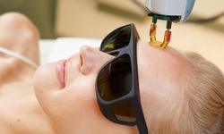 One, Two, or Three IPL Facial Treatments at Laser Center and Spa (Up to 81% Off)