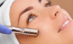 One Microdermabrasion Treatment w/ Optional Facial & Cranial or Decollete Massage at Cale Salon (Up to 56% Off)