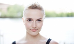 Microdermabrasion and Peel at Dutch Hollow Medical Day Spa (Up to 60% Off). Three Options Available.
