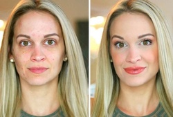 Up to 71% Off on IPL Photo Facial at Shape Of You