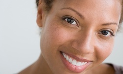 One or Two Micropeel Treatments at NU Age Aesthetics (Up to 64% Off)