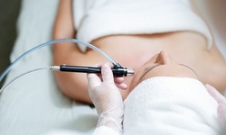 Up to 71% Off Microdermabrasion with Facial at Aesthetics by Kate