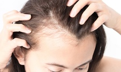 One or Four Laser Hair Regrowth Treatments with Consultation & Analysis at Elite Spa (Up to 86% Off)