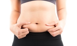 Four-Week Weight Loss Program with Laser Lipo at CHC Weight Loss Center (Up to 62% Off)