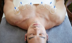 Up to 63% Off on Cupping at Brandon Massage Oasis