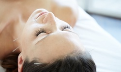 Consultation and Evaluation with One or Two Acupuncture Treatments at Morales Acupuncture (Up to 69% Off)