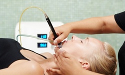 A Facial of Choice or One or Three Microdermabrasion Treatments at Prive Skin Care (Up to 74% Off)