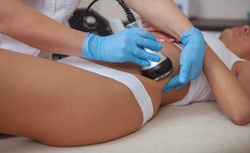5 or 8 Lipo-Cavitation or Radio-Frequency Treatments at Fat Freeze Away & Rejuvenation Center (Up to 72% Off)