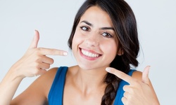 One or Two 60-Minute Teeth-Whitening Treatments at Bellavista Medi Spa (Up to 74% Off)