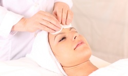 One Microdermabrasion with Optional Chemical Peel or Facial, or One Chemical Peel at Terra Spa (Up to 71% Off)