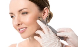 $25.50 for One Dermaplaning Treatment at Afzal Clinics ($80 Value)