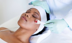 One, Two, or Four Microneedling Treatments at Permanent Makeup Arts (Up to 62% Off)