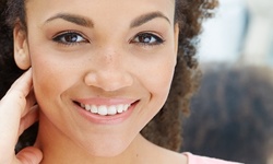 One, Two, or Three Microdermabrasion Treatments at Suite Six Medical Aesthetics (Up to 76% Off)