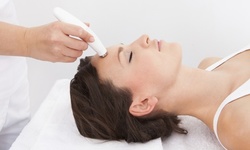 One, Three, or Five Microdermabrasion Treatments at Gentle Aesthetics Medical Spa (Up to 77% Off)