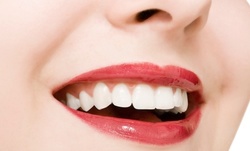 One or Two BleachBright Teeth-Whitening Treatments at Glo Tanning (Up to 56% Off)