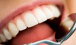 $31.20 for One Dental Exam with Cleaning and X-Ray at Smile Design ($389 Value)
