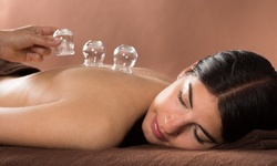 Initial Acupuncture Treatment, Cupping Therapy, or Both at Restore Sound Acupuncture (Up to 41% Off)